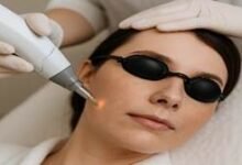 Laser treatment: The 5 most chosen applications and how effective they really are