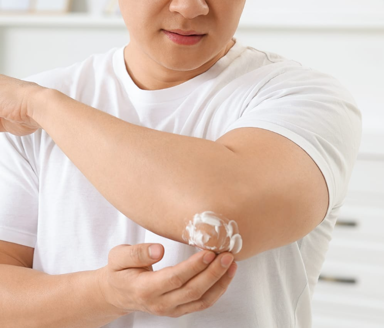 Should Eczema Lotion Sting When You Put It On? - selman tech || selmantech com || selmantech com app download